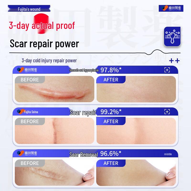 Fujita Pharmaceutical Medical Silicone Scar Repair Cream