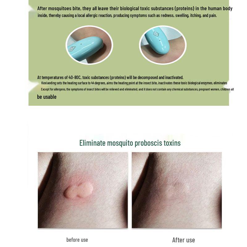 Mosquito Bite Itch Relief Pen for Babies and Children - Infrared, Quick & Rechargeable