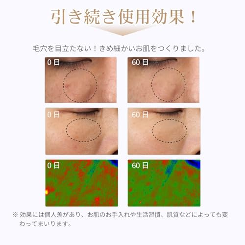 ANLAN LED Facial Beauty Mask, Facial Beauty Device, Illuminated Beauty Treatment, 5-Color LED Light, Heating Mask, Facial Heating Care, IPX5 Waterproo