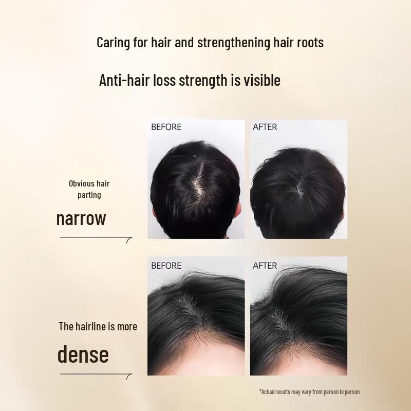 Yunnan Baiyao Yang Yuan Qing Fluffy Strong Anti-Hair Loss & Oil Control Shampoo