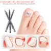 2 ks Nástroj pro korekci zarostlého nehtu Zarostlý nehet Léčba Elastická náplast Samolepka Narovnávání nehtů Pedikúrní nástroje