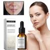 Essence Éclaircissante à l'Acide Tranexamique, Essence Éclaircissante à l'Acide Hyaluronique, Sérum d'Acide Hyaluronique Pur pour le Visage, Sérum Correcteur de Taches Brunes