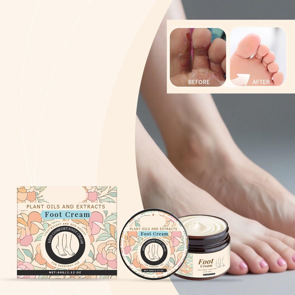 Foot Soothing Cream Is Light, Non-greasy, Quickly Absorbed, Reduces Fatigue, Moisturizes Dryness And Is Suitable For Daily Care.