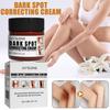 Jaysuing Moisturizing Cream For Joints Hydrating Body Care Lotion For Elbows And Knees