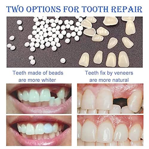 Teeth Repair Kit, Fills Chipped, Broken, and Gapped Dentures, Includes Moldable False Teeth and Heat Bead Replacement Kit. Fills Chipped, Broken, and