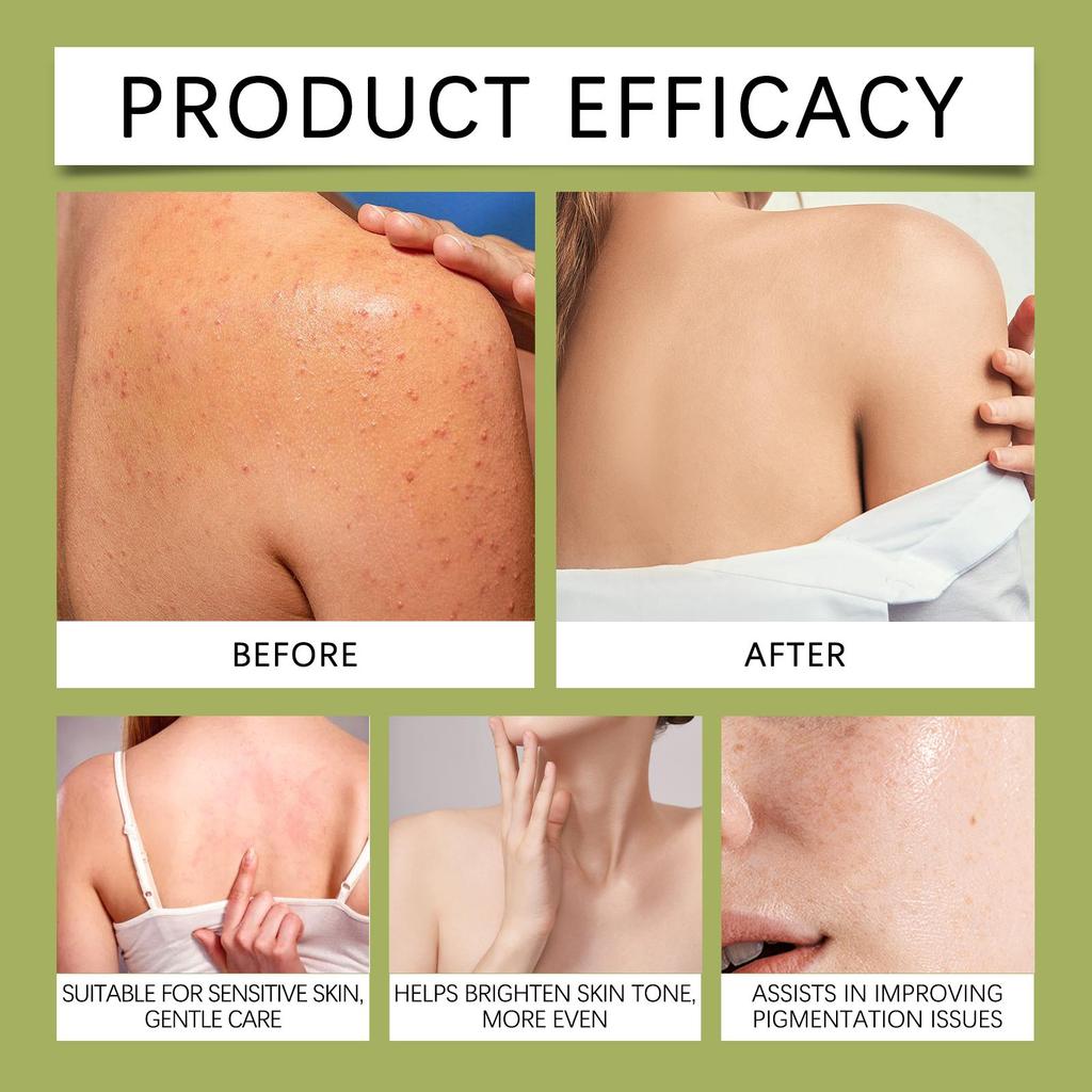 Rozjasňující mýdlo s kurkumou a kyselinou kojovou Odstraňovač tmavých skvrn Hloubkově čisticí Hydratační Sjednocuje tón pleti Ručně vyráběné mýdlo Péče o pleť