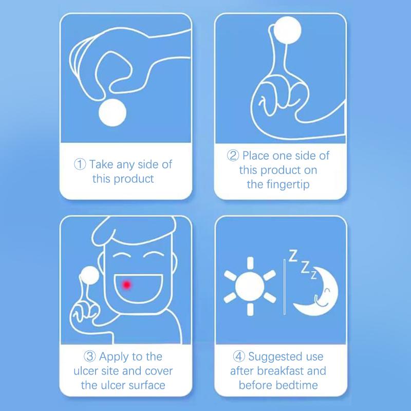 Szybka Pielęgnacja Plaster na Owrzodzenia Jamy Ustnej Opatrunek na Rany Jamy Ustnej Do Aft Szybka Ulga w Bólu Lek na Afty Środek Przeciwbólowy