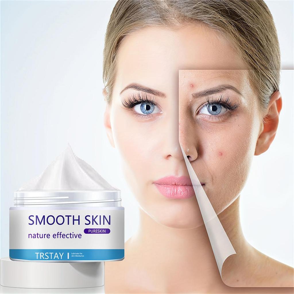 Whitening and Acne Removing Essence Cream, Brightening Facial Skin, Anti-oxidation and Anti-aging, Moisturizing Cream