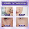 B3 Serum, Dark Spot Corrector B3 Serum With Anti-Aging 10% Niacinamide Discoloration Correcting Serum for Sun Spots, Age Spots & Post-Acne Marks