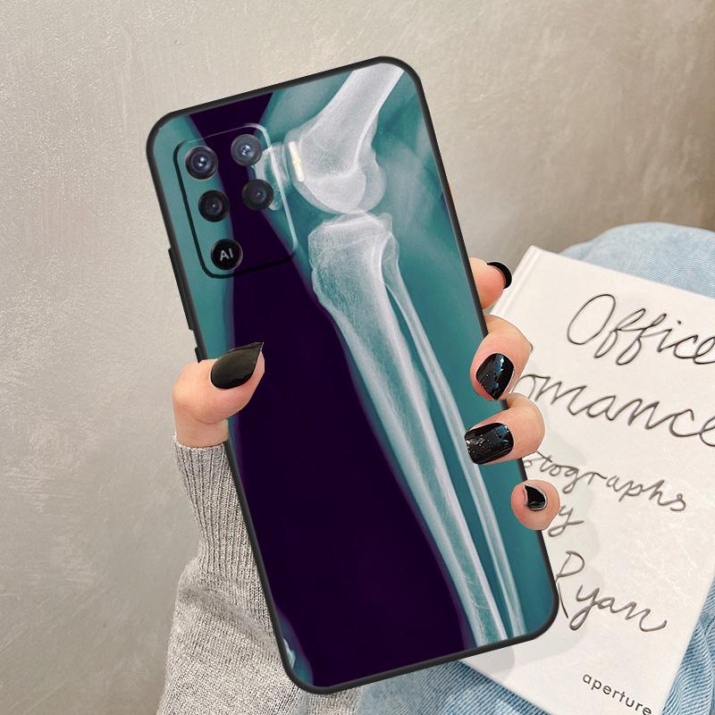

Чехол-кейс с рентгеновской анатомией человека для Oppo A40 A60 A80 A78 A38 A18 A98 A58 A96 A76 A16 A94 A74 A54 A15 A17 A57 A77 A5 Pro OPPO A60 5G