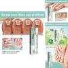 Caneta Reparadora de Unhas South Moon Com Fórmula Nutritiva Para Cuidados Gerais com Mãos e Pés