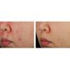 PURCELL PixelBiome Konzentrat Serum 30ml