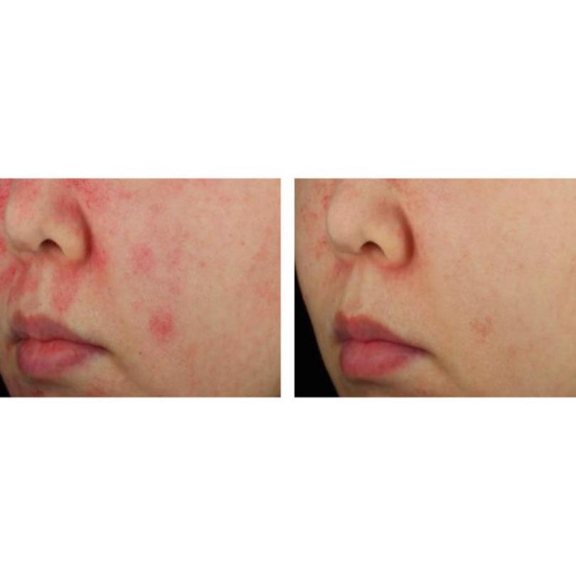 PURCELL PixelBiome Konzentrat Serum 30ml