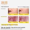 RUNBEN Teen Oil Control Acne Treatment Skincare Set