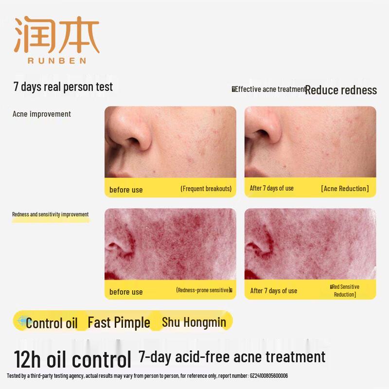 RUNBEN Teen Oil Control Acne Treatment Skincare Set