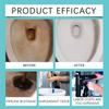 Toilet Cleaning Bottle, Cute Toilet Cleaner, Effectively Cleans, Reduces Odor And Keeps Fresh For A Long Time(10ml)