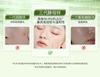Botanical Acne Removing & Lustrous Repairing Facial Mask for Children