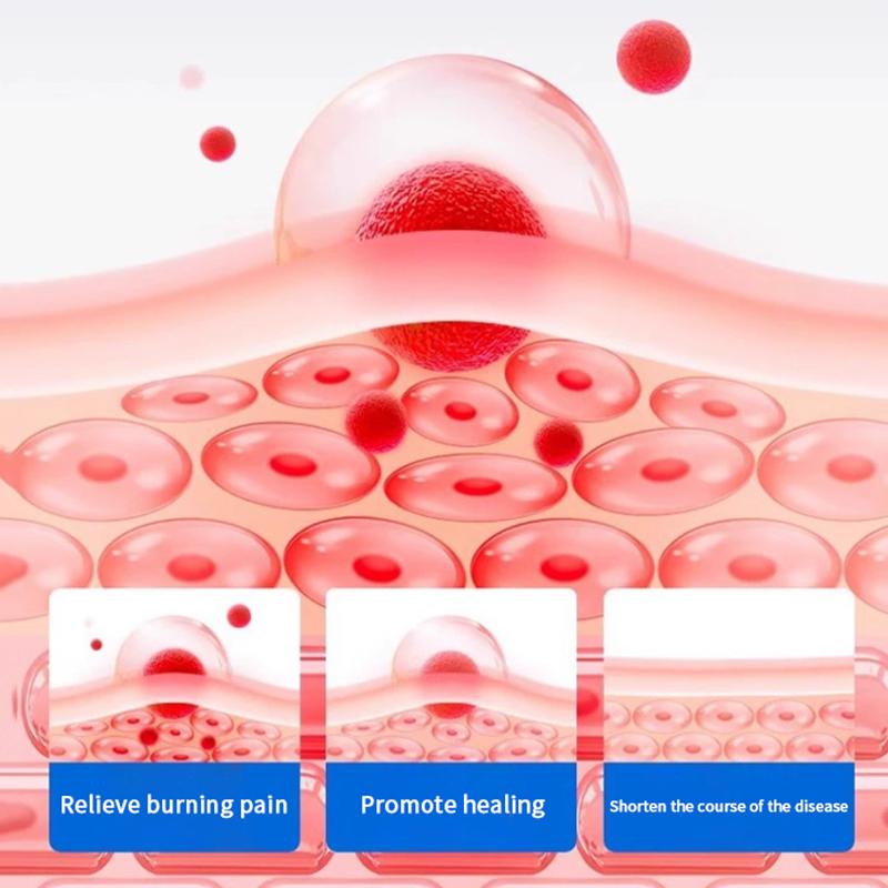 

8 шт. Терапия при проблеме язв во рту Наклейки от афтозного стоматита Обезболивание Заживление ран Продукты для ухода за полостью рта