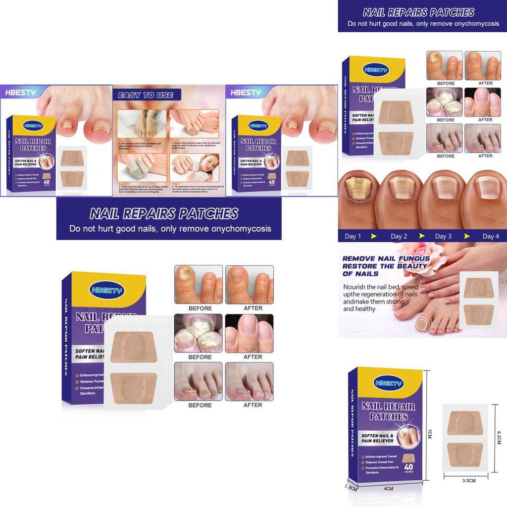 Hbesty Toenail Repair Patches For Damaged Soft Nails With Herbal Scented Comfort 40 Count