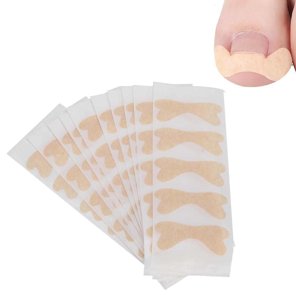 10Sheets Ingrown Toenail Correction Tool Removal Correction Patch Pedicure Healthy Care Tool