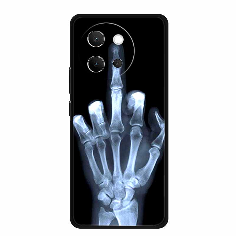 For Vivo V40 Lite Case Black Silicone Soft Back Cover Case For Vivo V40 Lite 5G Phone Case Cover V 40 V40lite 6.78" Funda Coque