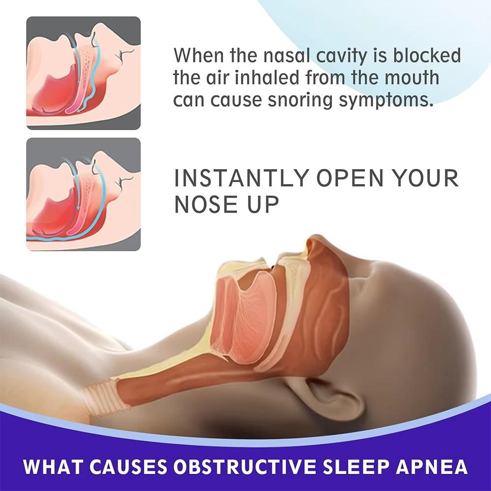 30Pcs Breath Nasal Strips Anti-Snoring Nose Patches Improve Sleeping Health Product To Stop Snoring Easier Sleep Aid Decive