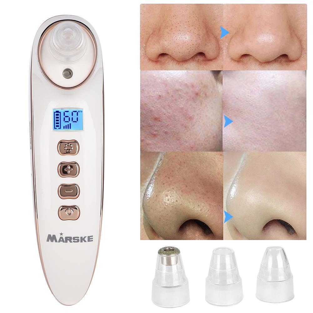 MARSKE Blackhead Removal Machine Electric Face Pore Acne Cleaning MachineWhite
