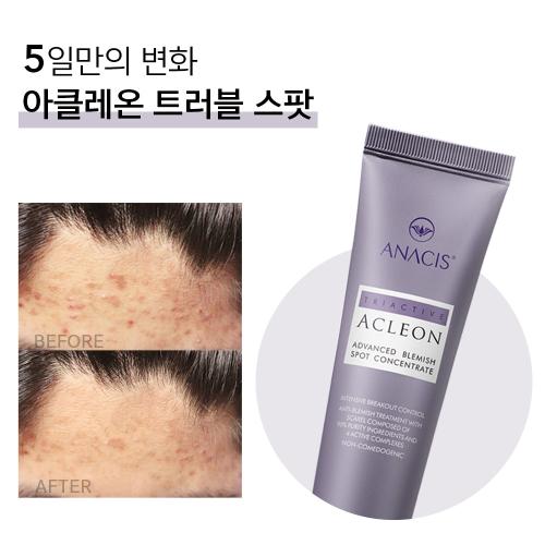 Acleon Youth Acne Skincare Ampoule & Spot Treatment Duo
