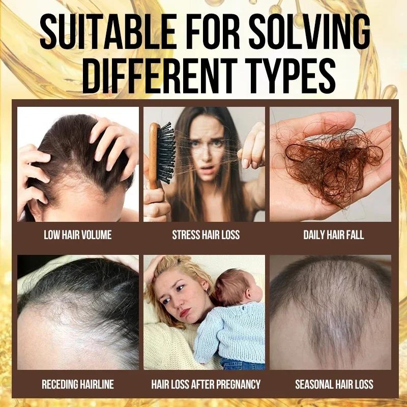 Produits en Spray Anti-Chute de Cheveux Sérum Capillaire Huile Essentielle Traitement au Gingembre Cheveux Secs Crépus Abîmés Nourrir