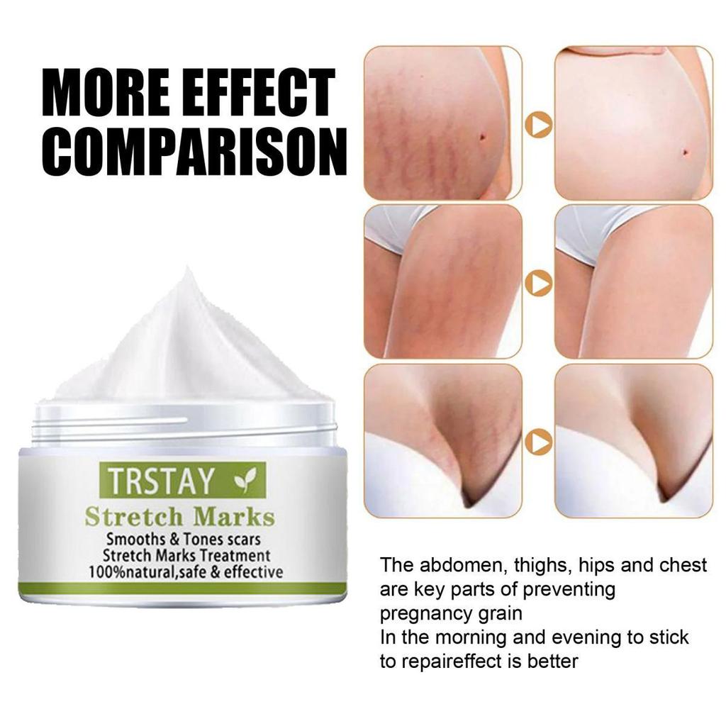 Masážní olej proti celulitidě – zpevňuje, zpevňuje pokožku – strie