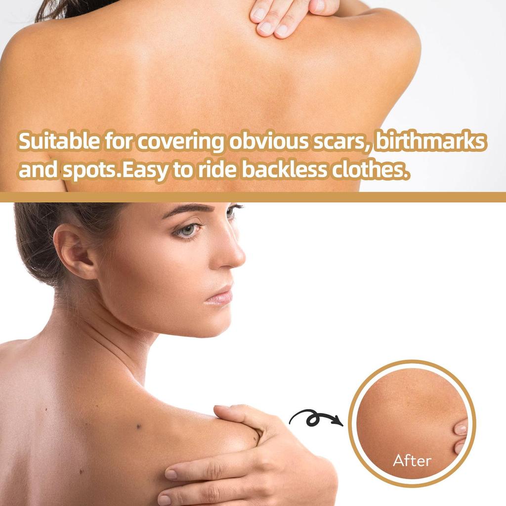 Scar Cover Sticker Scars Tattoos Birthmarks Tape Invisible Body Spot Patch Blemishes Concealer B0T6
