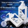 Salicylic Acid Facial Cleanser for Acne & Oil Control