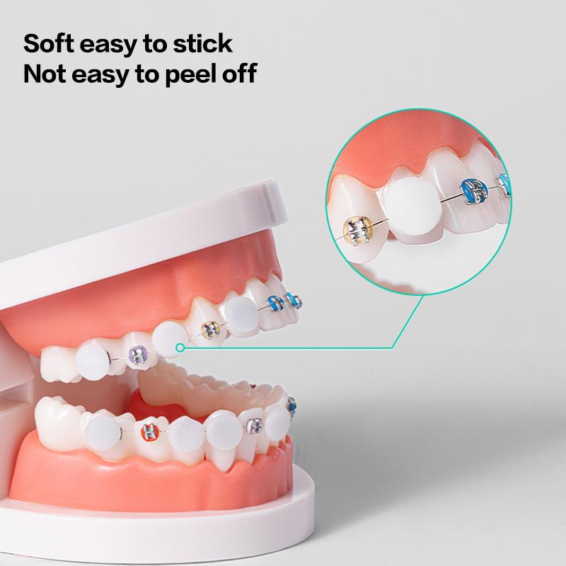 60Pcs Dental Orthodontic Wax Protective Brace Wax Orthodontic Anti-Grinding Food Grade Individually Packaged Superior Hygiene