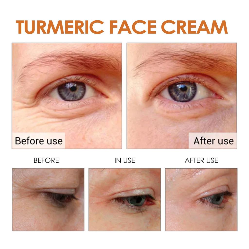 Turmericantiwrinkle Moisturizingcream, Turmericantiwrinklecream, Deep Moisturizing, Longterm Maintenance Of Skin Stability, Skin Care,50ML