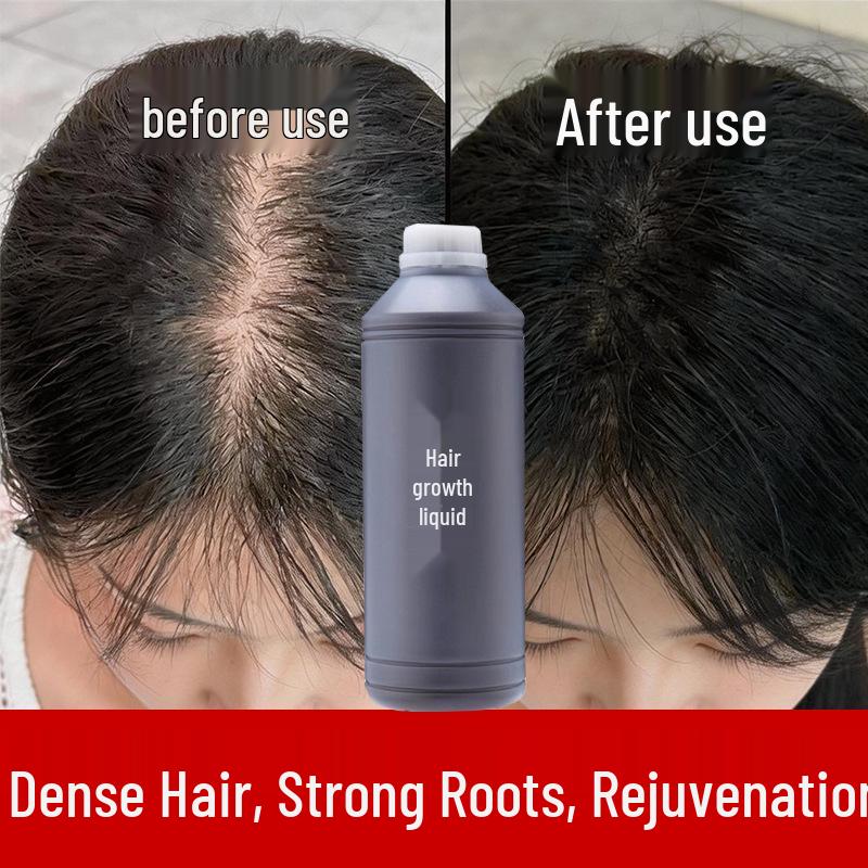 Herbal Hair Growth & Thickening Lotion: Anti-Hair Loss, Follicle Repair, Accelerated Hairline & Hair Density Enhancement.