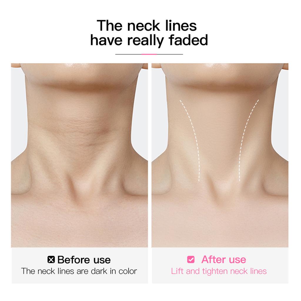 10 Stück Transparente Halsstraffungs-Pflaster Wasserdicht Elastizität Unsichtbar Faltenreduzierend Hals Klebe-Sticker Face Lift Tape