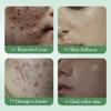 Salicylic Acid Nourishing Essence Milk SADOER Moisturizing Hydrating Refreshing Water Milk