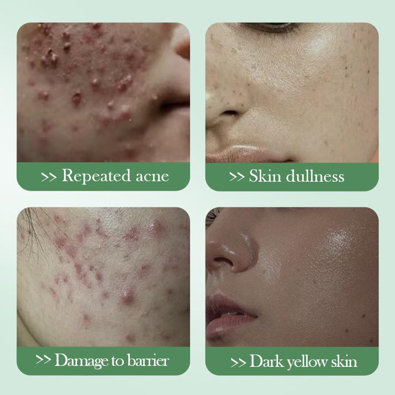 Salicylic Acid Nourishing Essence Milk SADOER Moisturizing Hydrating Refreshing Water Milk