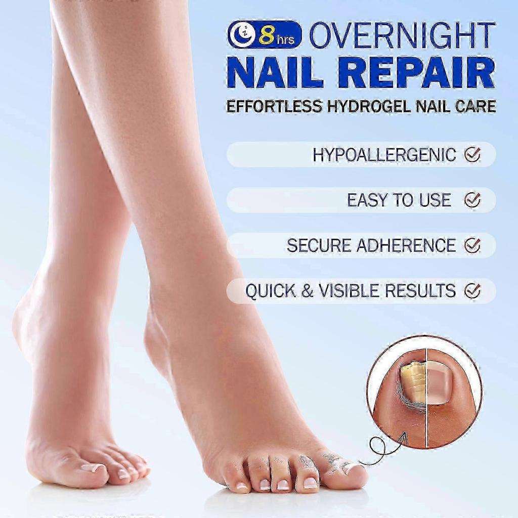 Oenail Fungus Patch Waterproof Nail Repair Patches Nail Ingrown Correction Stickers For Discolored Or Damaged Nails Treatment