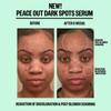 Peace Out Dark Spots Supercharged Brightening Serum 1.0 Oz