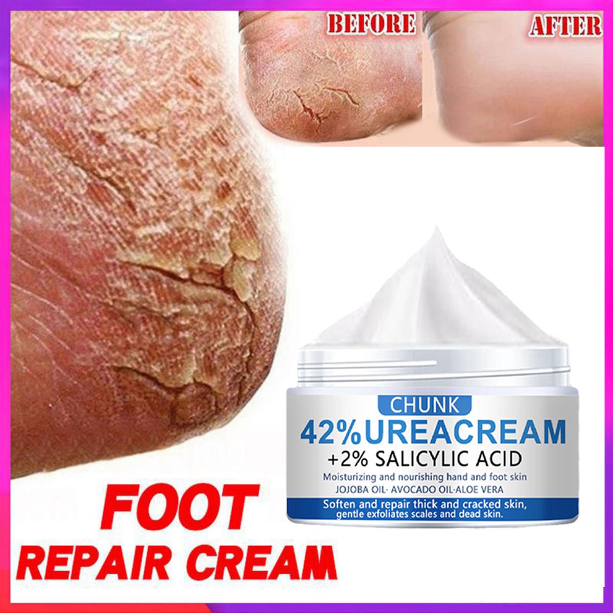 

Крем для ног против трещин, восстановление трещин на пятках, отбеливающий крем для кожи, антивозрастной крем для лица