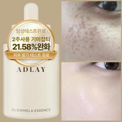 Ampola Essência Clareadora Corretora de Manchas Adelay 50 mL – Pigmentação, Melasma e Sérum Iluminador