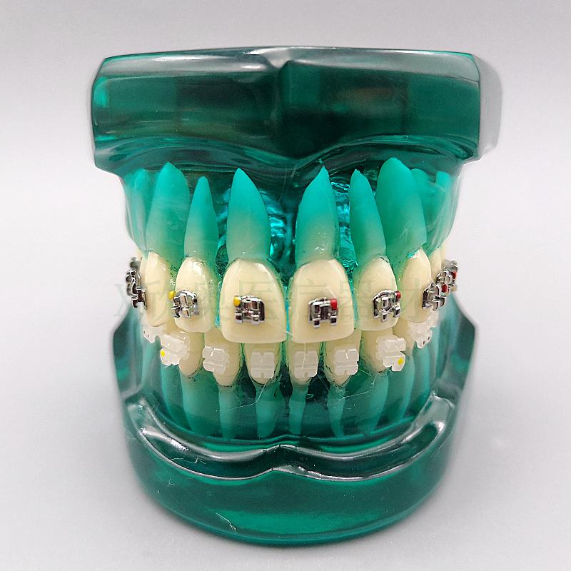 Zahnmedizinisches Lehr-Modell Ortho Metall/Keramik Mit/Ohne Bracket Zahnmedizinische Zubehörteile Kieferorthopädie Zahnersatz Modellierwerkzeug