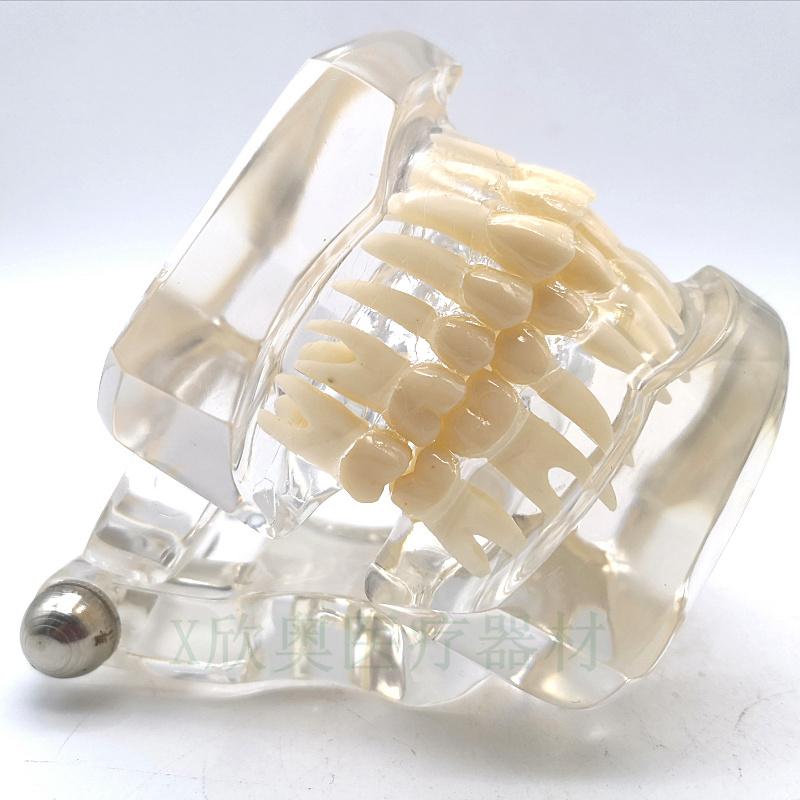Zahnmedizinisches Lehr-Modell Ortho Metall/Keramik Mit/Ohne Bracket Zahnmedizinische Zubehörteile Kieferorthopädie Zahnersatz Modellierwerkzeug