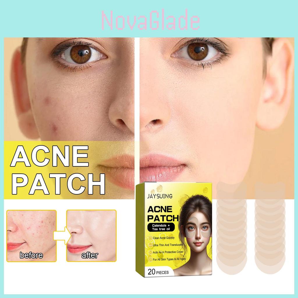 Jaysuing Acne Patches For Clear Skin 20pcs Effective Blackhead Removal Treatment