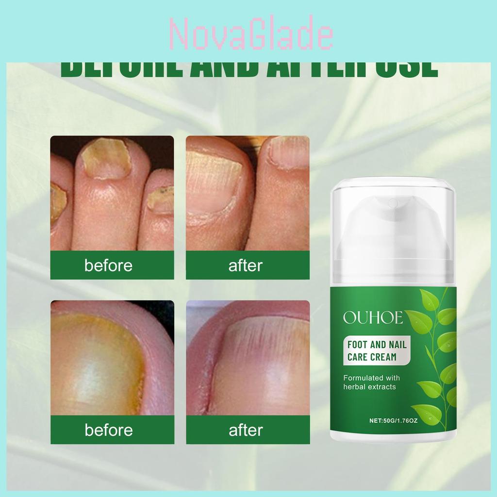 Ouhoe Nourishing Foot And Nail Care Cream For Soft Moisturized Healthy Feet