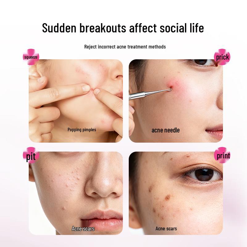 Ousijie Anime Makeup Thin Pimple Patches