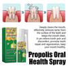 New model 1-3x Oral Care Spray, Bad Breath Spray, Probiotics Mouth Spray Bad Breath Freshener Oral Spray for Breath Freshening