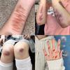 Horror Realistic Fake Bloody Wound Stitch Scar Scab Waterproof Temporary Tattoo Sticker Halloween Masquerade Prank Makeup Props