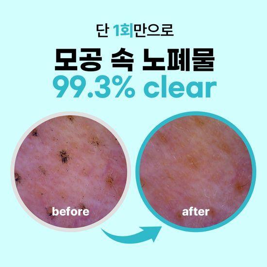 Point and Deep Clean Whip Cleansing Foam 100g